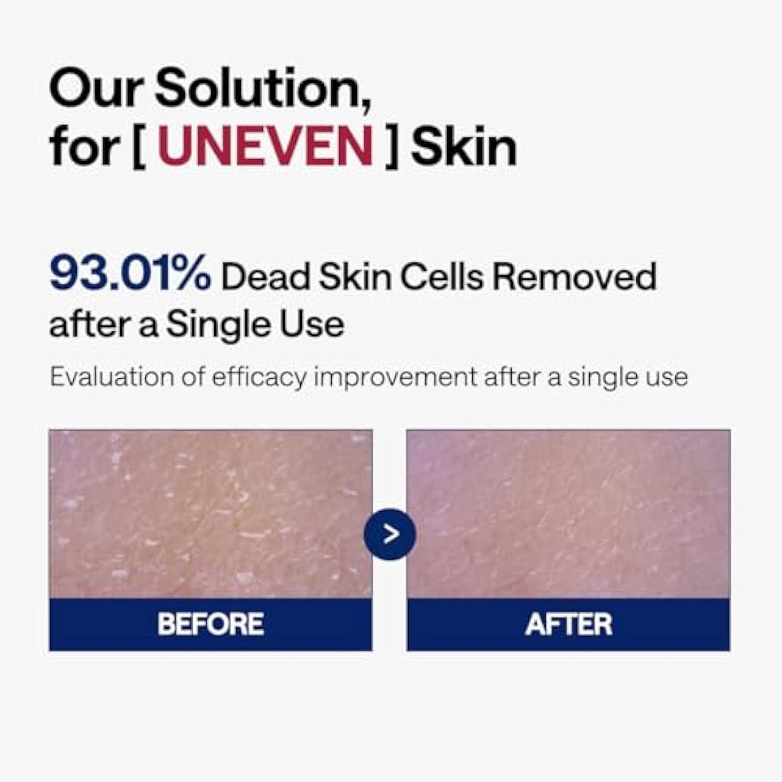 MEDIHEAL Phyto Enzyme Peeling Pad | Vegan LHA Exfoliating Pads - 90ct