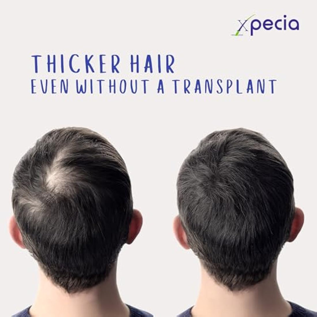 Xpecia for Men DHT Blocker Hair Growth Supplement - 180 Tablets