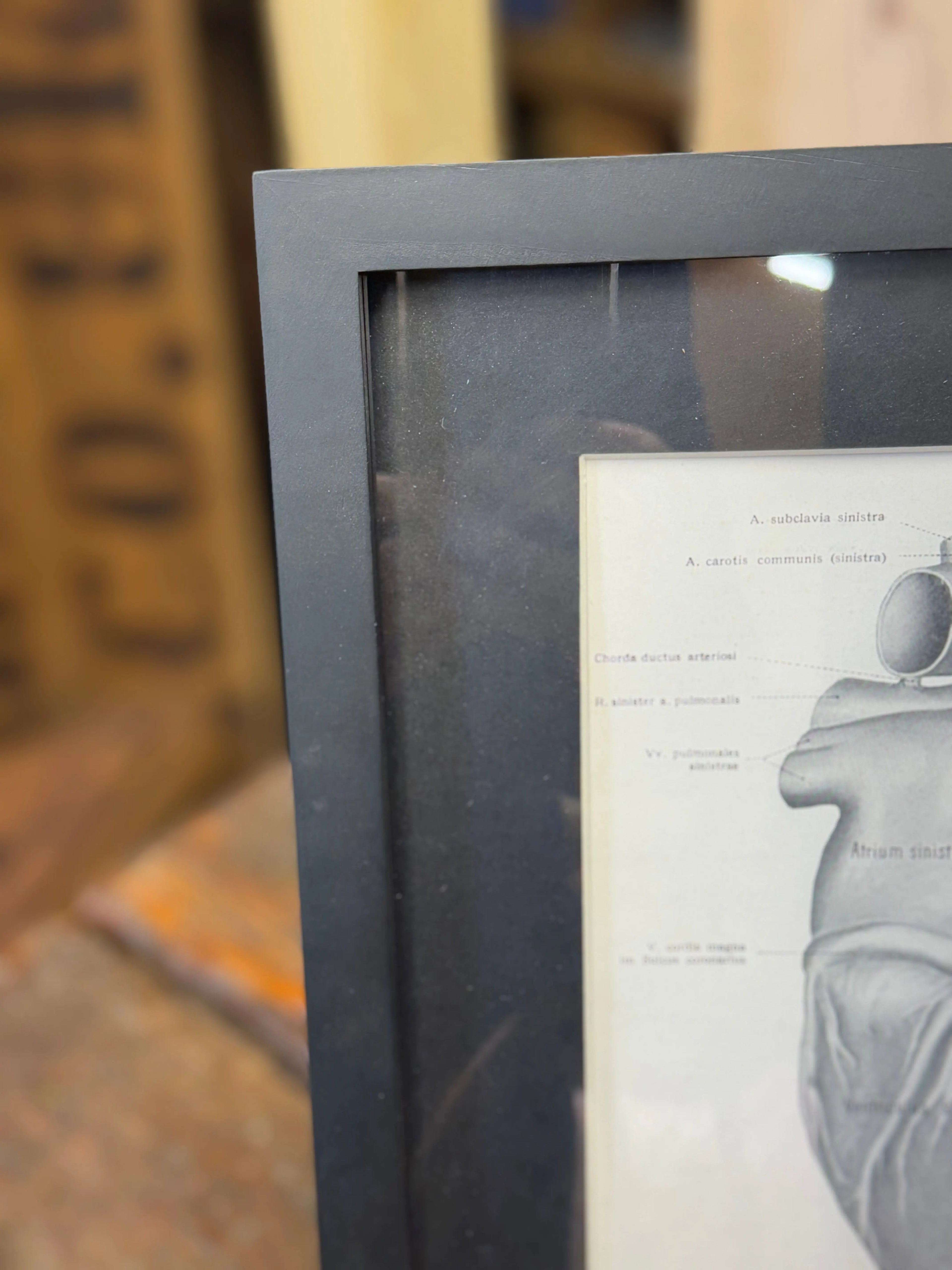 Framed Antique Anatomy Print 1920s Medical Book Plate Wall Art Picture T