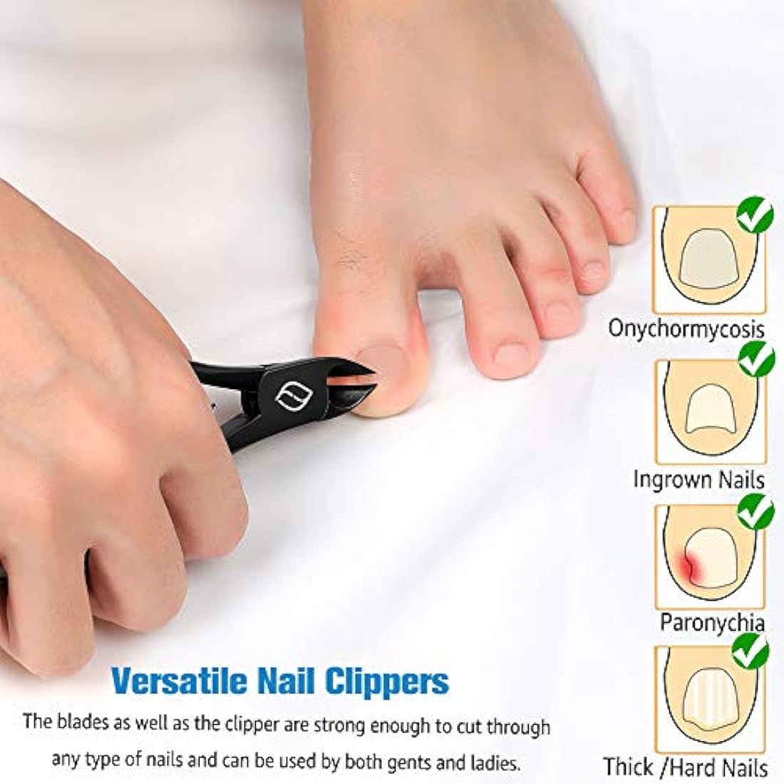 FERYES Toenail Clippers for Thick Nails – Stainless Steel Podiatry Tool