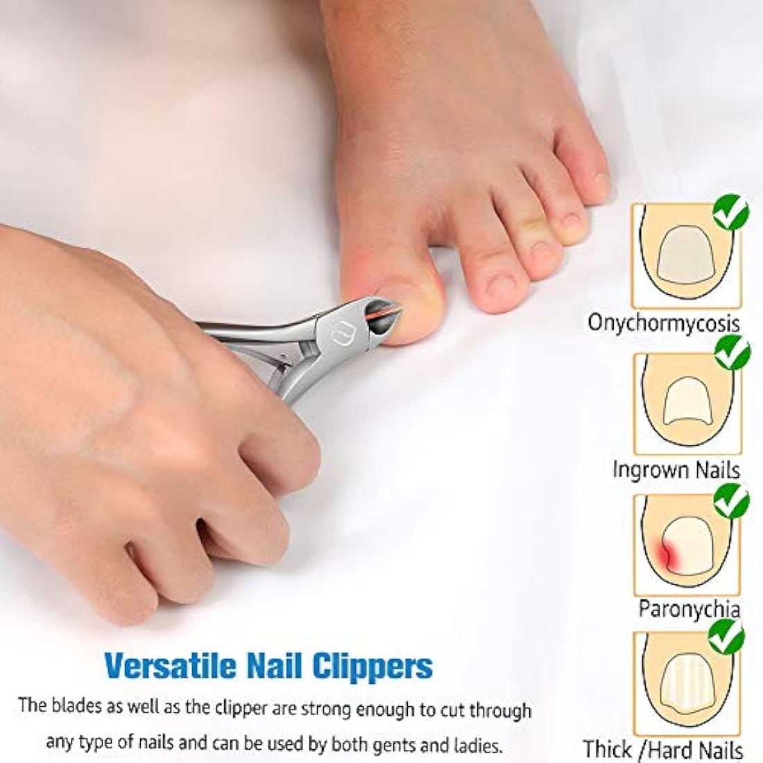 FERYES Thick Toenail Clippers – Stainless Steel Ingrown Nail Tool