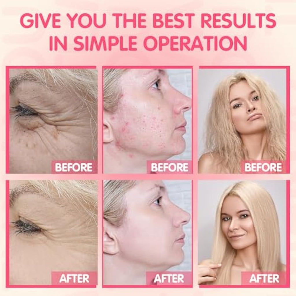 TUMAKOU High Frequency Facial Machine – Neon Skin Therapy Wand with 4 Tubes