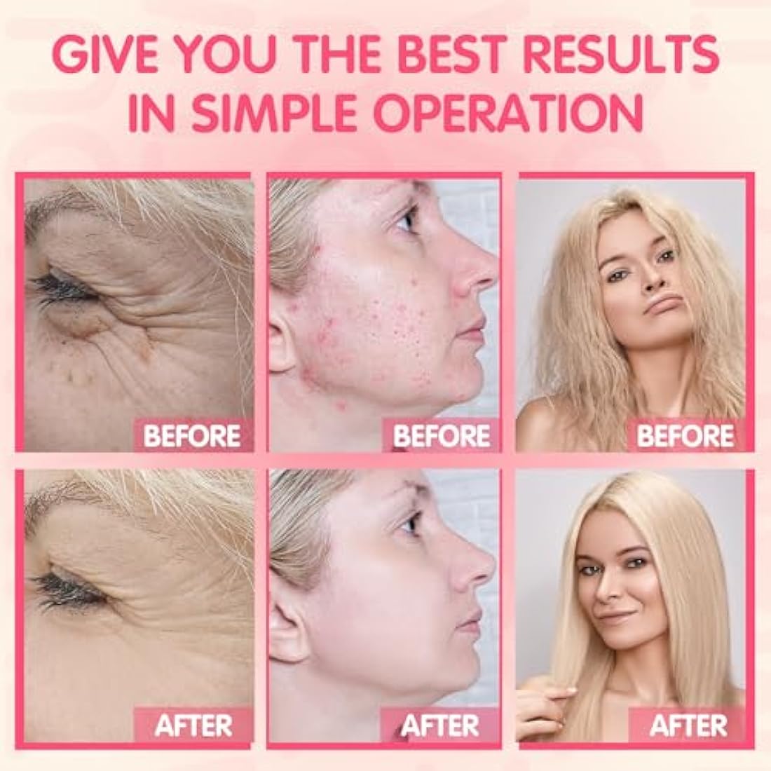TUMAKOU High Frequency Facial Machine – Neon Skin Therapy Wand with 4 Tubes