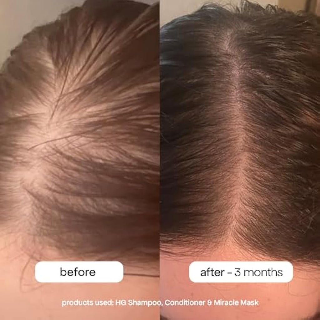 BondiBoost HG Duo Shampoo & Conditioner Set for Thinning Hair - 10.14oz