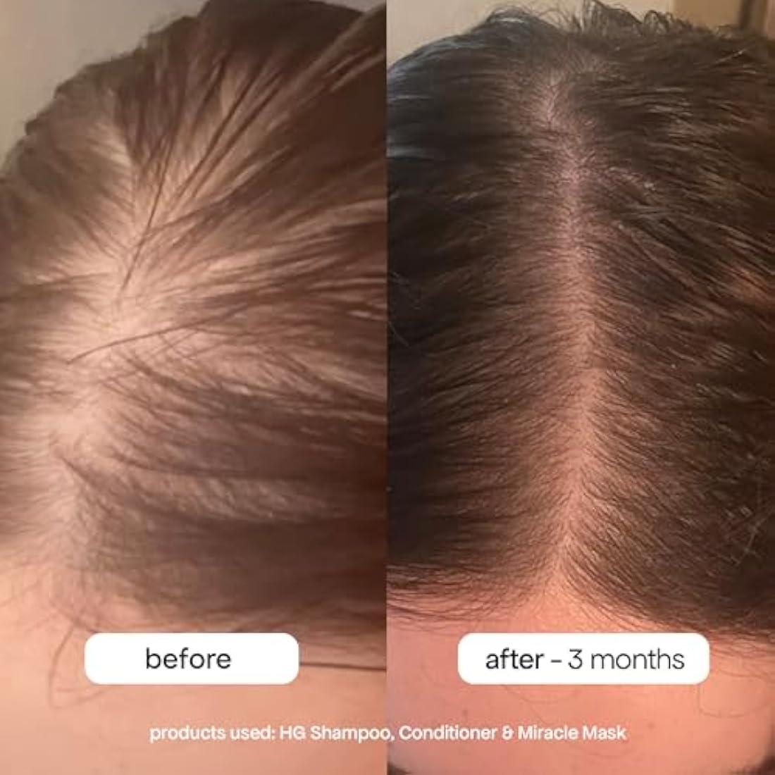 BondiBoost HG Duo Shampoo & Conditioner Set for Thinning Hair - 10.14oz