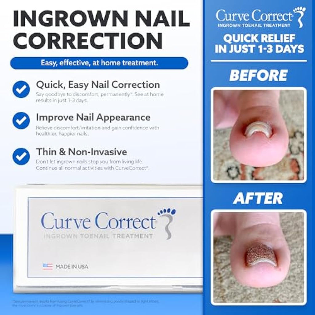 CurveCorrect Ingrown Toenail Home Treatment Kit – Nail Braces for Big Toe