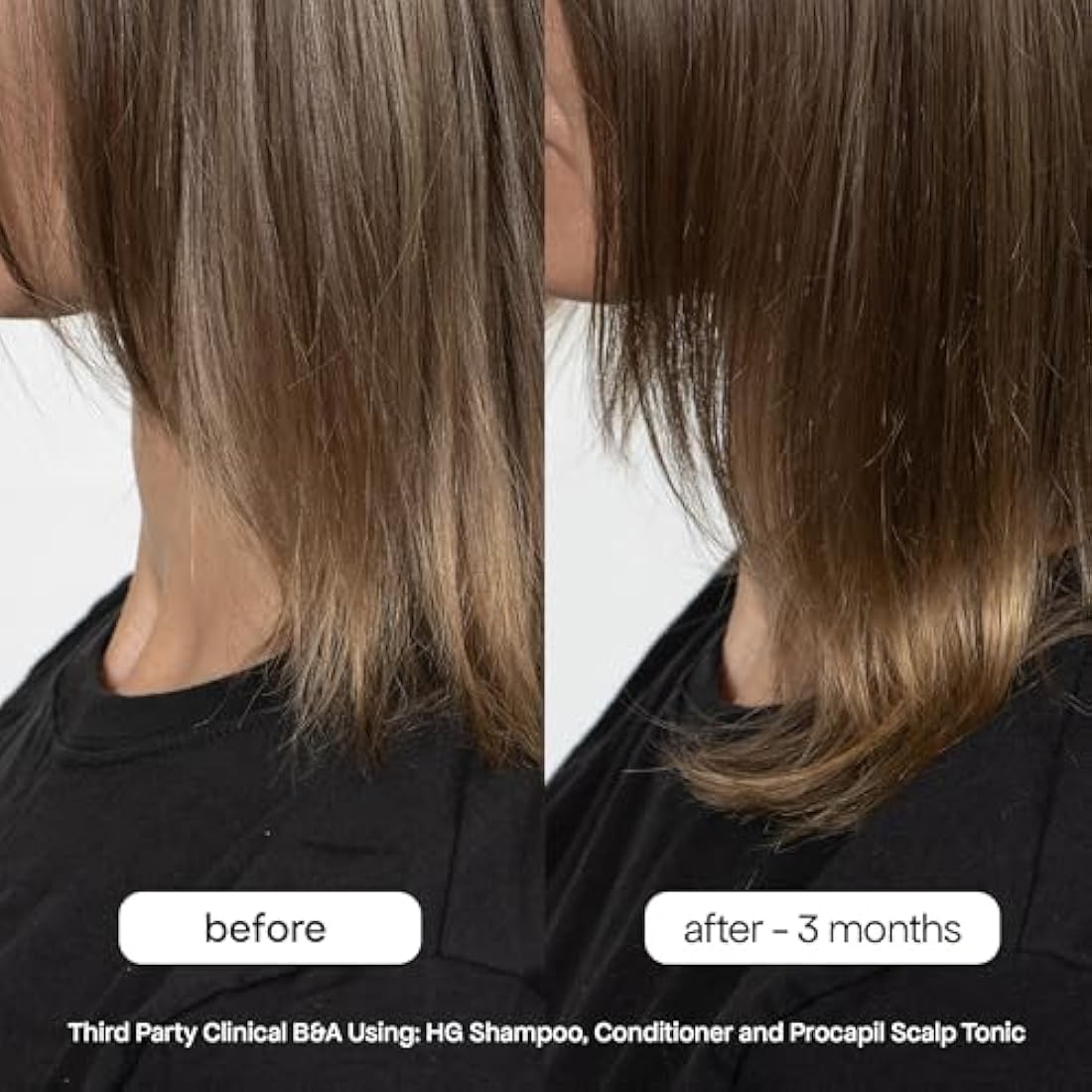BondiBoost HG Duo Shampoo & Conditioner Set for Thinning Hair - 10.14oz
