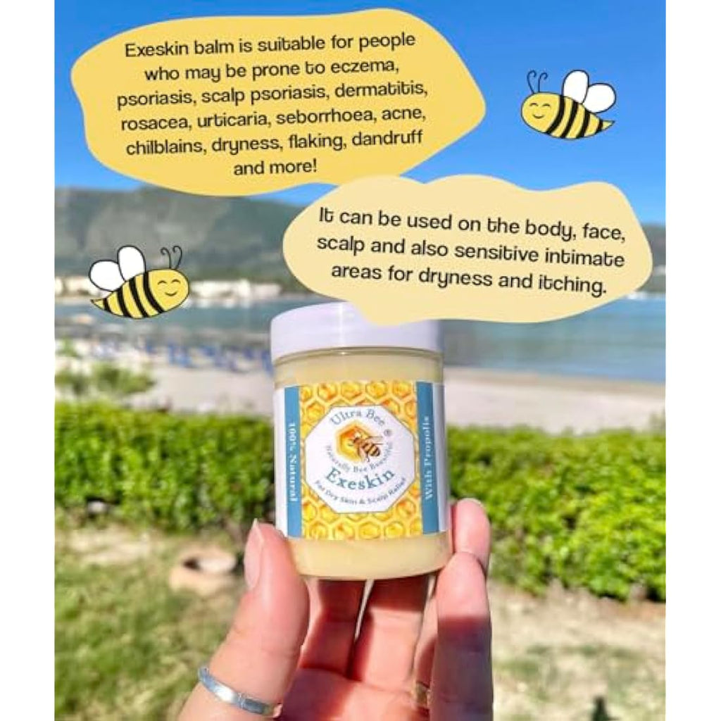 Exeskin Balm 200ml – Natural Eczema & Psoriasis Relief