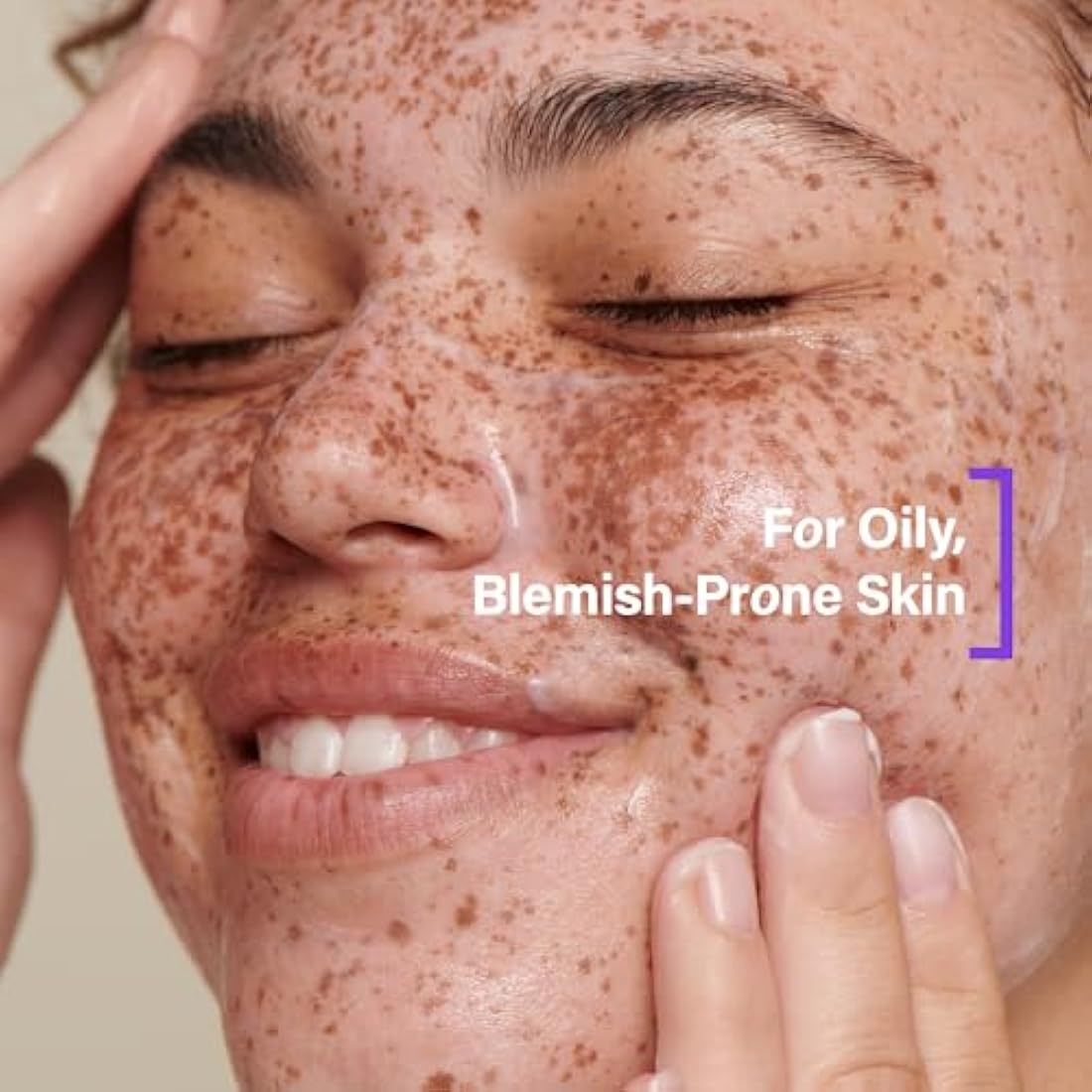 Coats Blemish Defence Duo – Clay Cleanser & Water Cream for Oily Skin