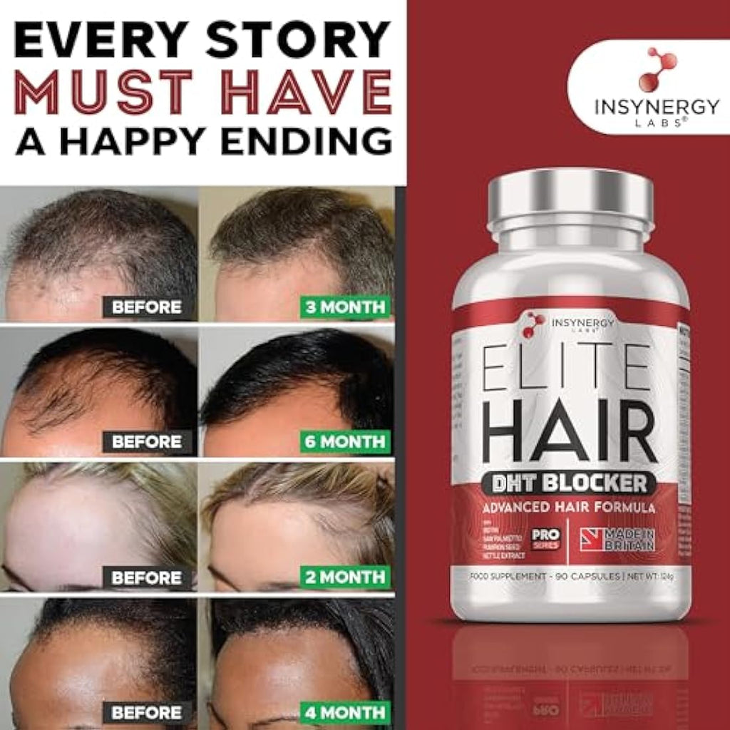 Insynergy Labs DHT Blocker Hair Growth Supplement - 90 Capsules