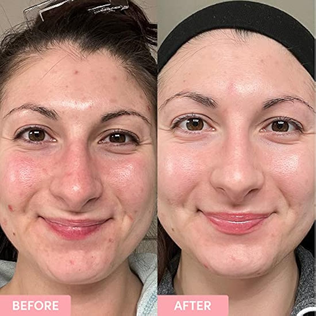 Sand & Sky Brightening Toner | Niacinamide & Glycolic Acid Essence