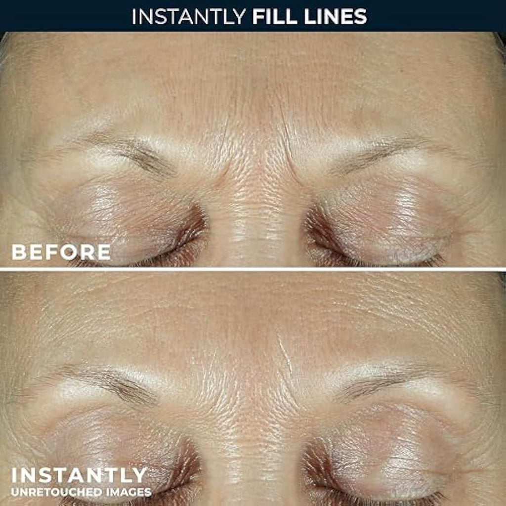 RoC Derm Correxion Retinol Serum – Wrinkle Filler with Hyaluronic Acid