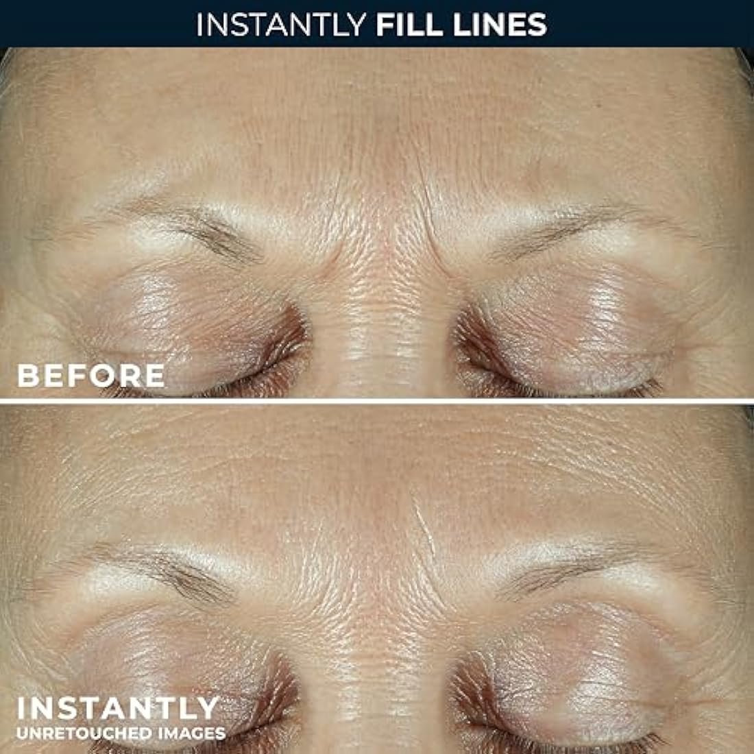 RoC Derm Correxion Retinol Serum – Wrinkle Filler with Hyaluronic Acid