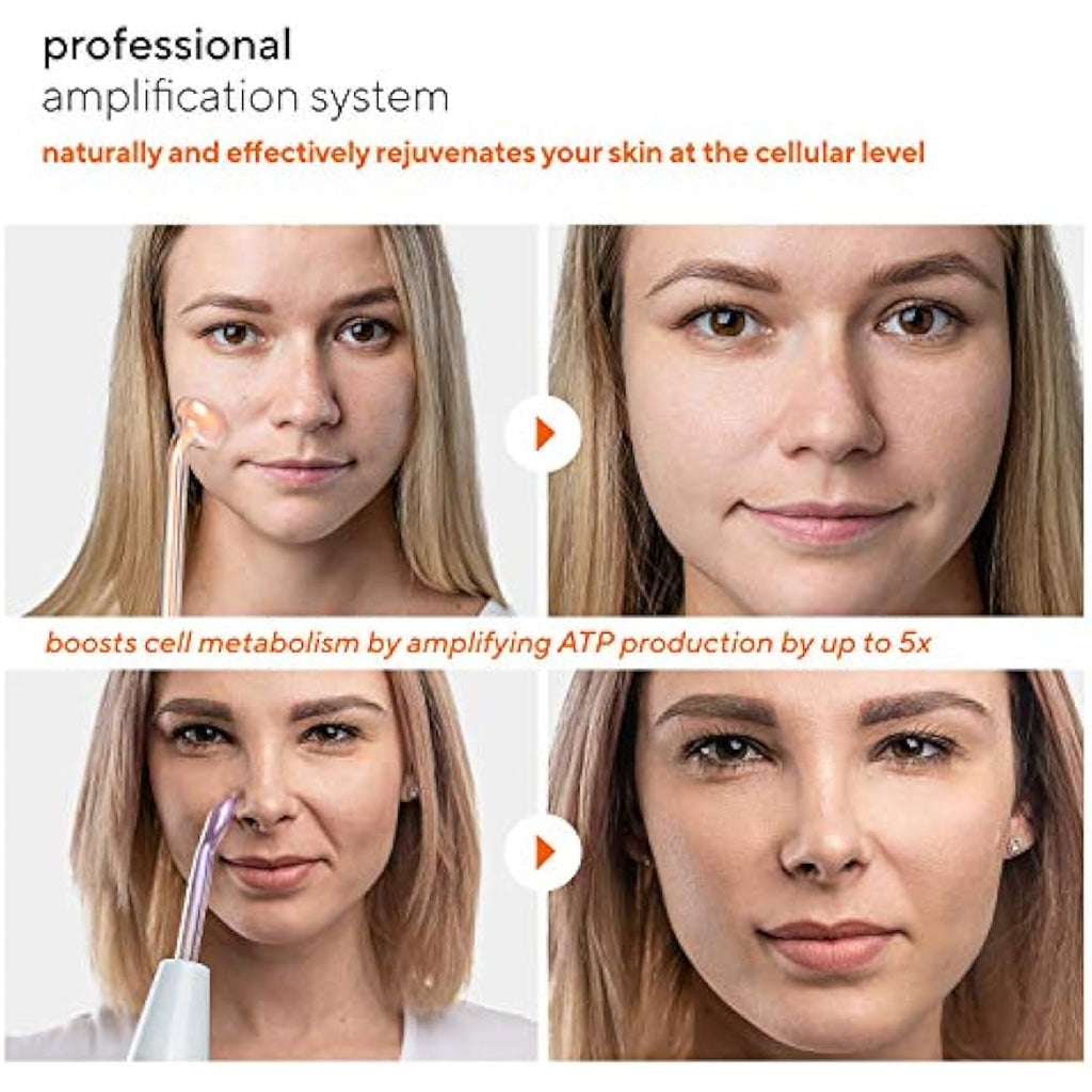 NuDerma Professional High Frequency Skin Therapy Wand with 6 Wands