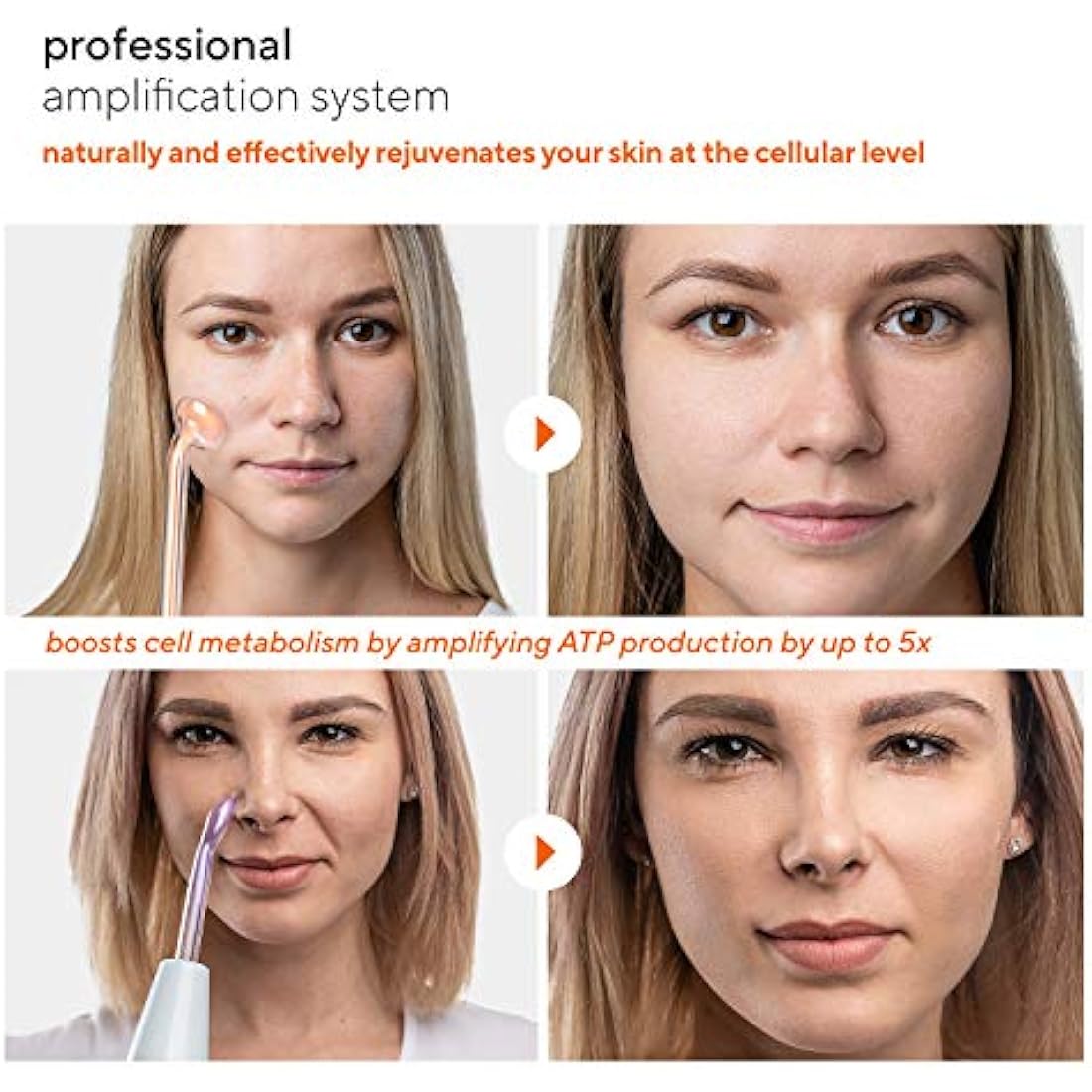 NuDerma Professional High Frequency Skin Therapy Wand with 6 Wands
