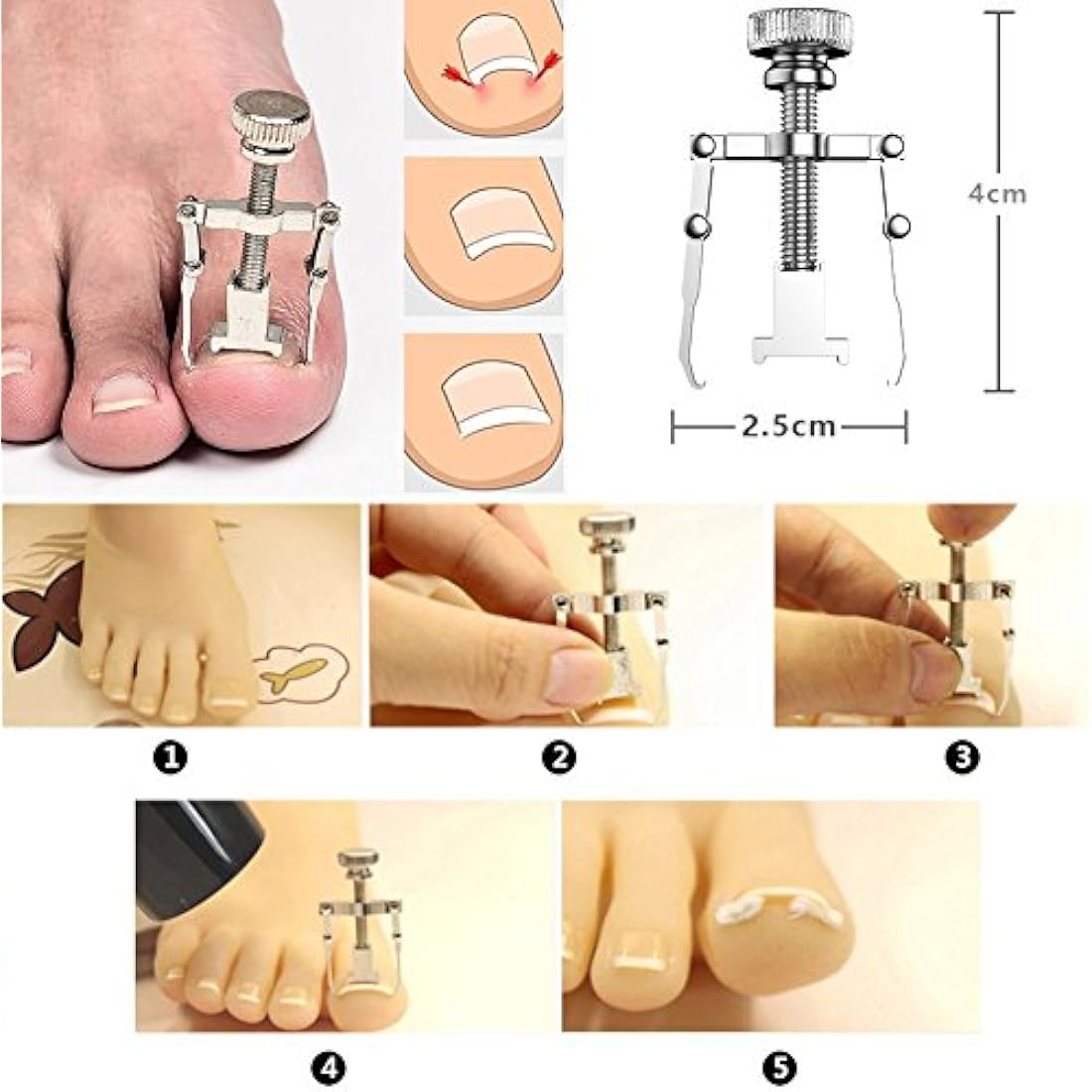 MojiDecor 6-Piece Ingrown Toenail Kit | Stainless Steel Pedicure Set