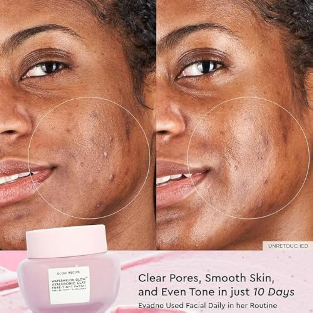 Glow Recipe Watermelon Glow Hyaluronic Clay Pore-Tight Facial - 60ml
