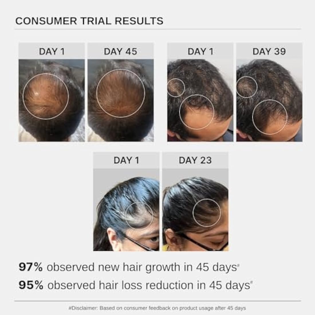 Bare Anatomy Hair Growth Serum - Redensyl & Anagain - Pack of 3