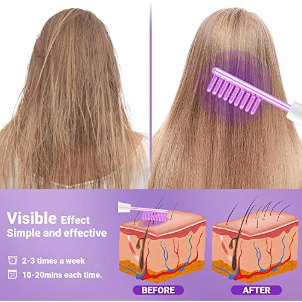 UUPAS High Frequency Facial Wand – Argon Skin Machine with 4 Tubes