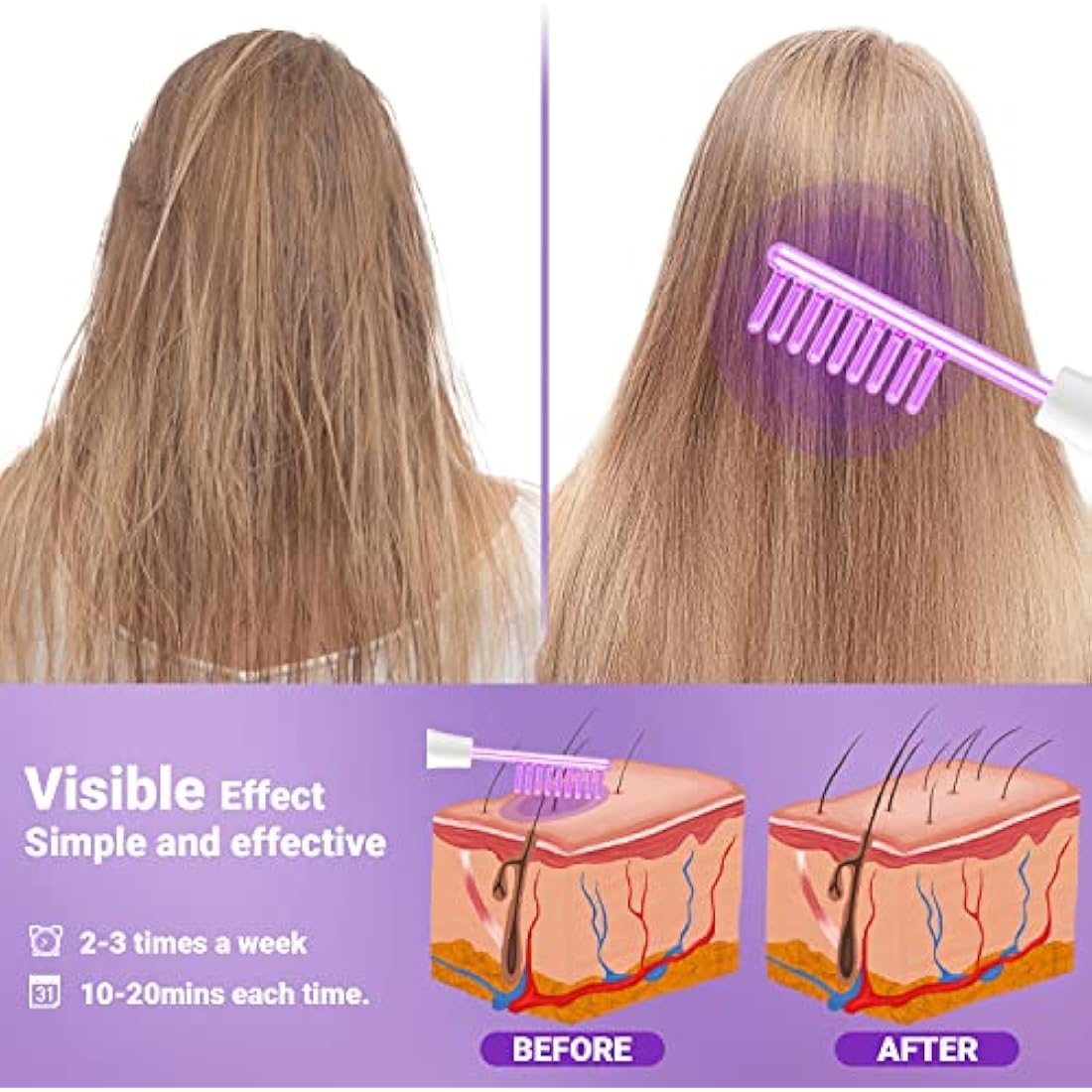 UUPAS High Frequency Facial Wand – Argon Skin Machine with 4 Tubes