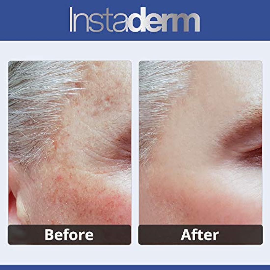 Dark Spot Corrector Cream – Moisturizing Skin Brightener