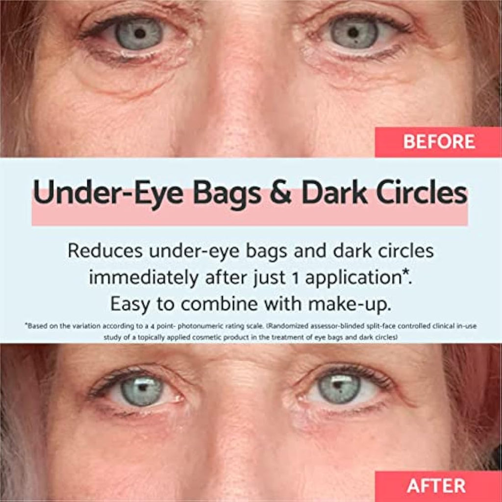 Remescar Eye Bags & Dark Circles Cream – Instant Puffy Eye Treatment 8ml