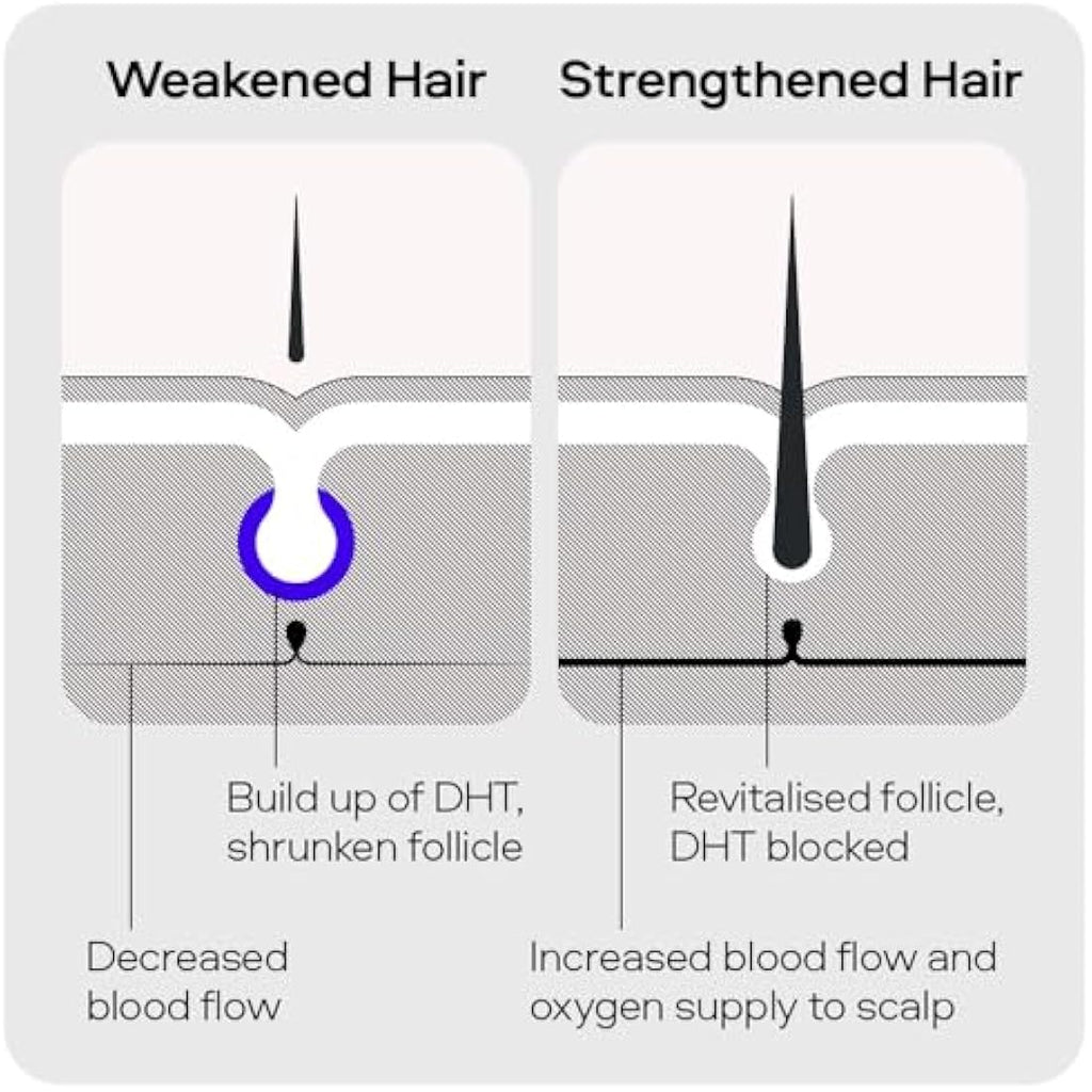 Sons Hair Growth Shampoo for Men | DHT Blocker & Thickening | 3 Pack