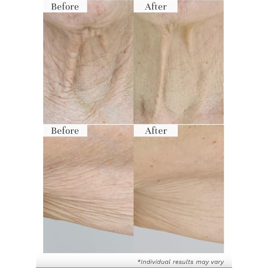 City Beauty InvisiCrepe Body Balm – Firming & Tightening Anti-Aging Lotion