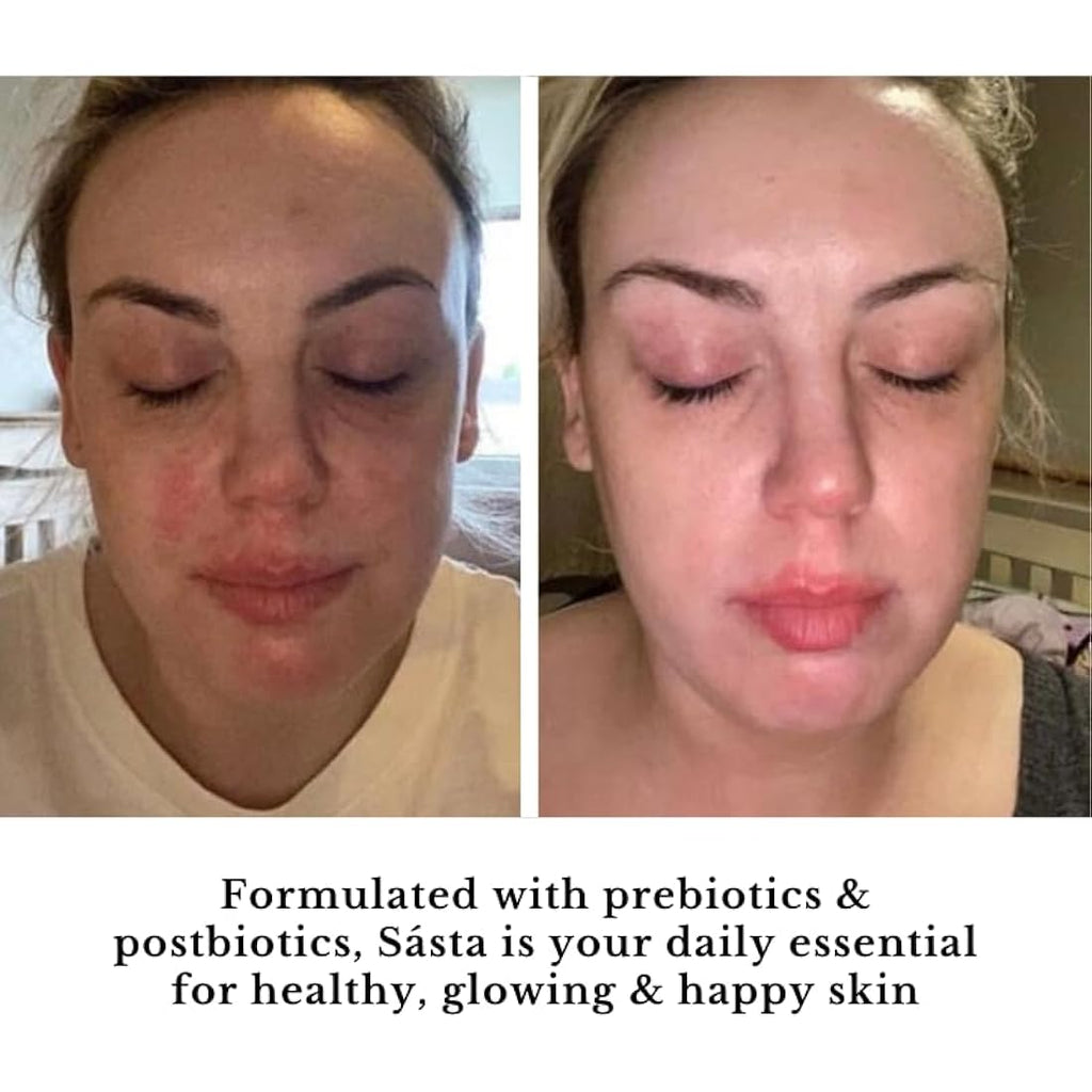 Sásta Microbiome Booster Serum – Prebiotic & Postbiotic Face Serum 30ml