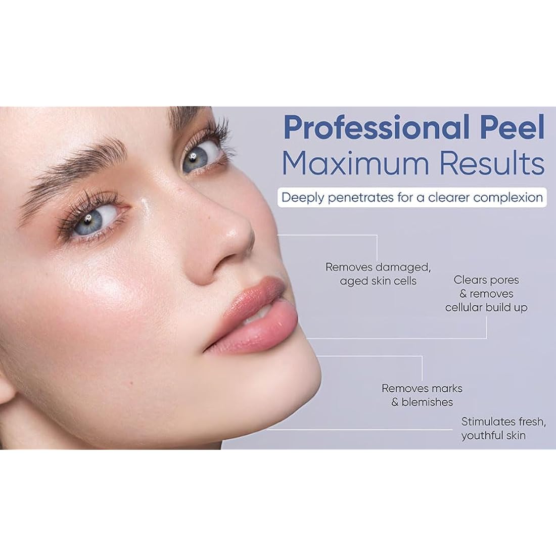 Skin Culture Peel 4000 – Deep Facial Peeling Kit for Acne Scars