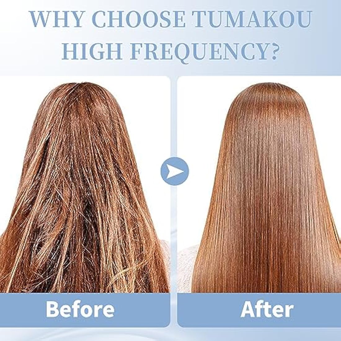 TUMAKOU High Frequency Facial Machine | Neon Skin Tightening Wand with 4 Tubes