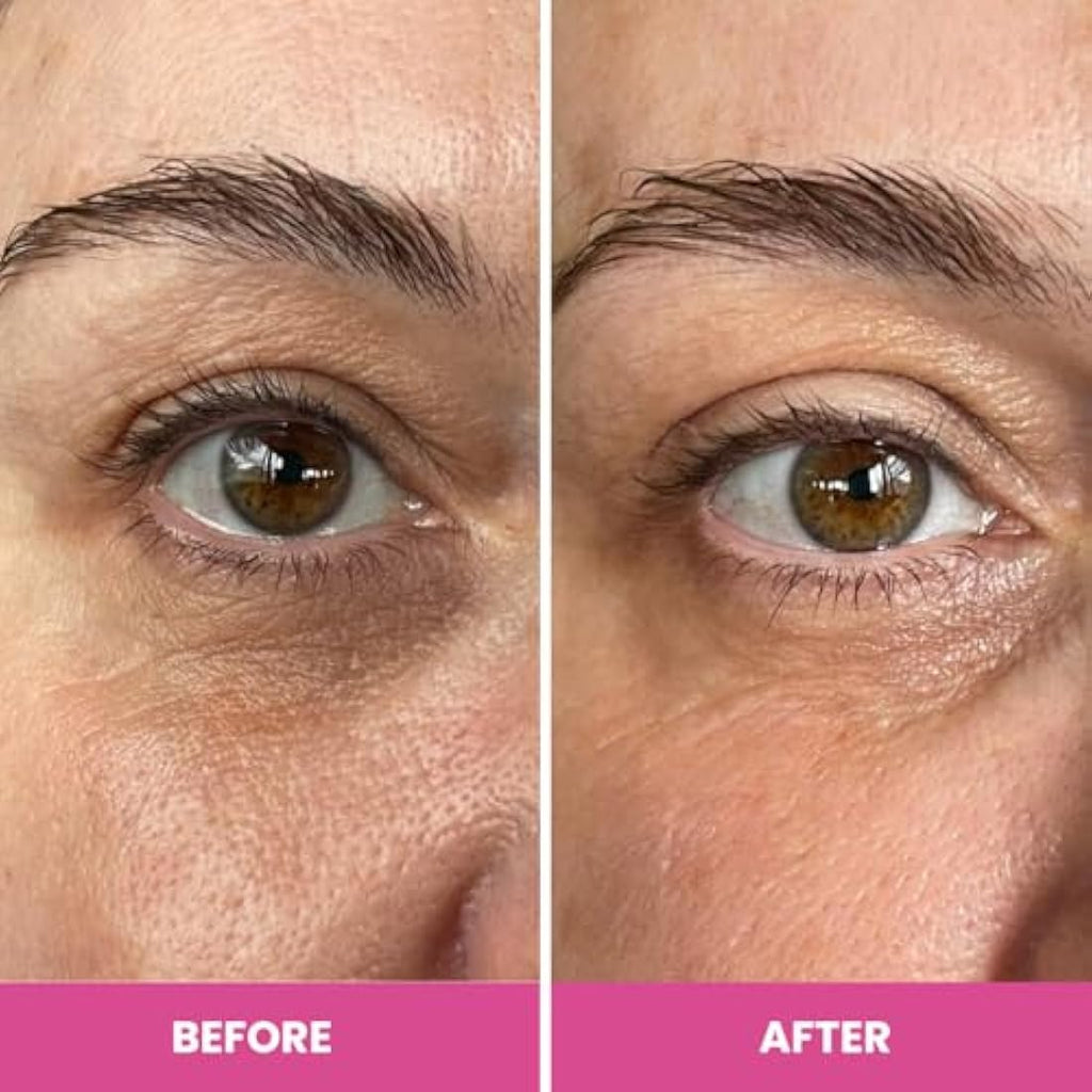 Prime Prometics PrimeEyes Hydrate Eye Cream for Dark Circles & Wrinkles