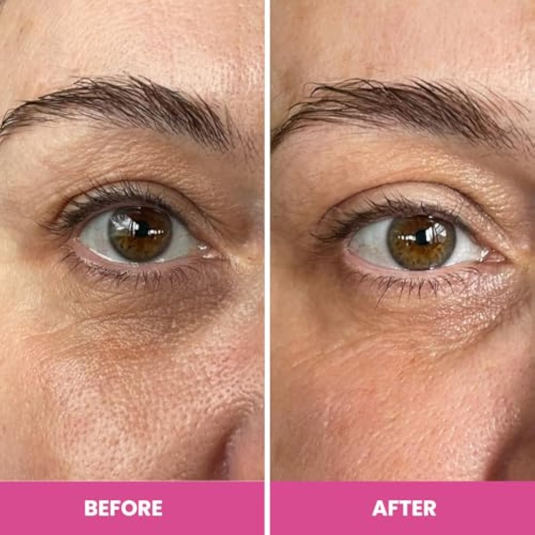 Prime Prometics PrimeEyes Hydrate Eye Cream for Dark Circles & Wrinkles