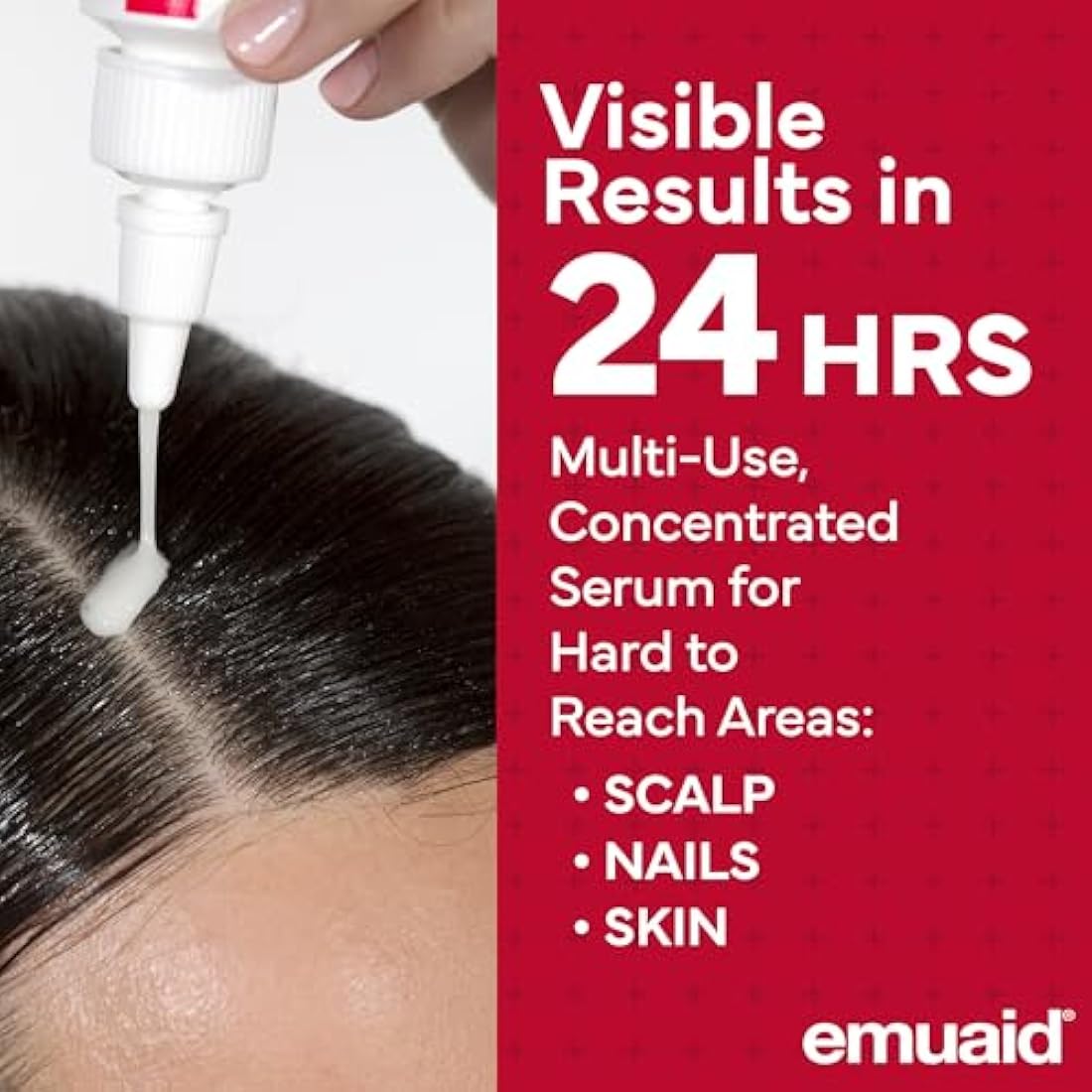 EMUAIDMAX First Aid Serum – Natural Eczema & Psoriasis Relief, 1 oz