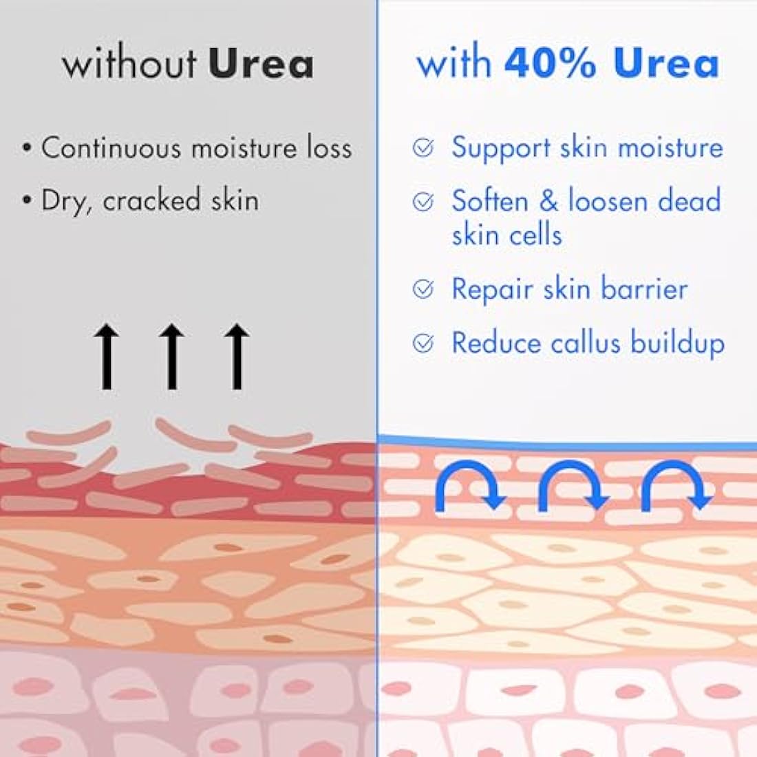 Urea Cream 40% with Salicylic Acid Callus Remover – 4.6 oz