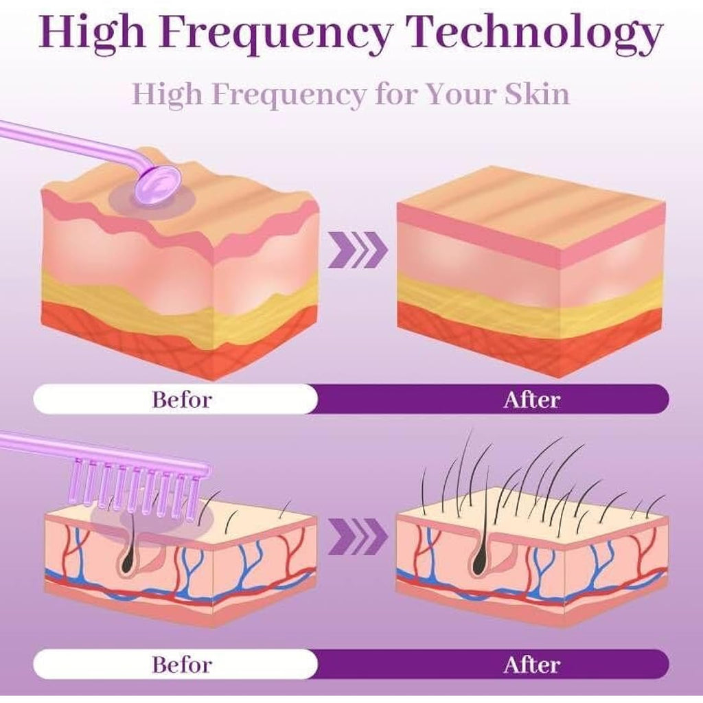 TUMAKOU High Frequency Facial Wand – Argon Light Therapy Skin Machine