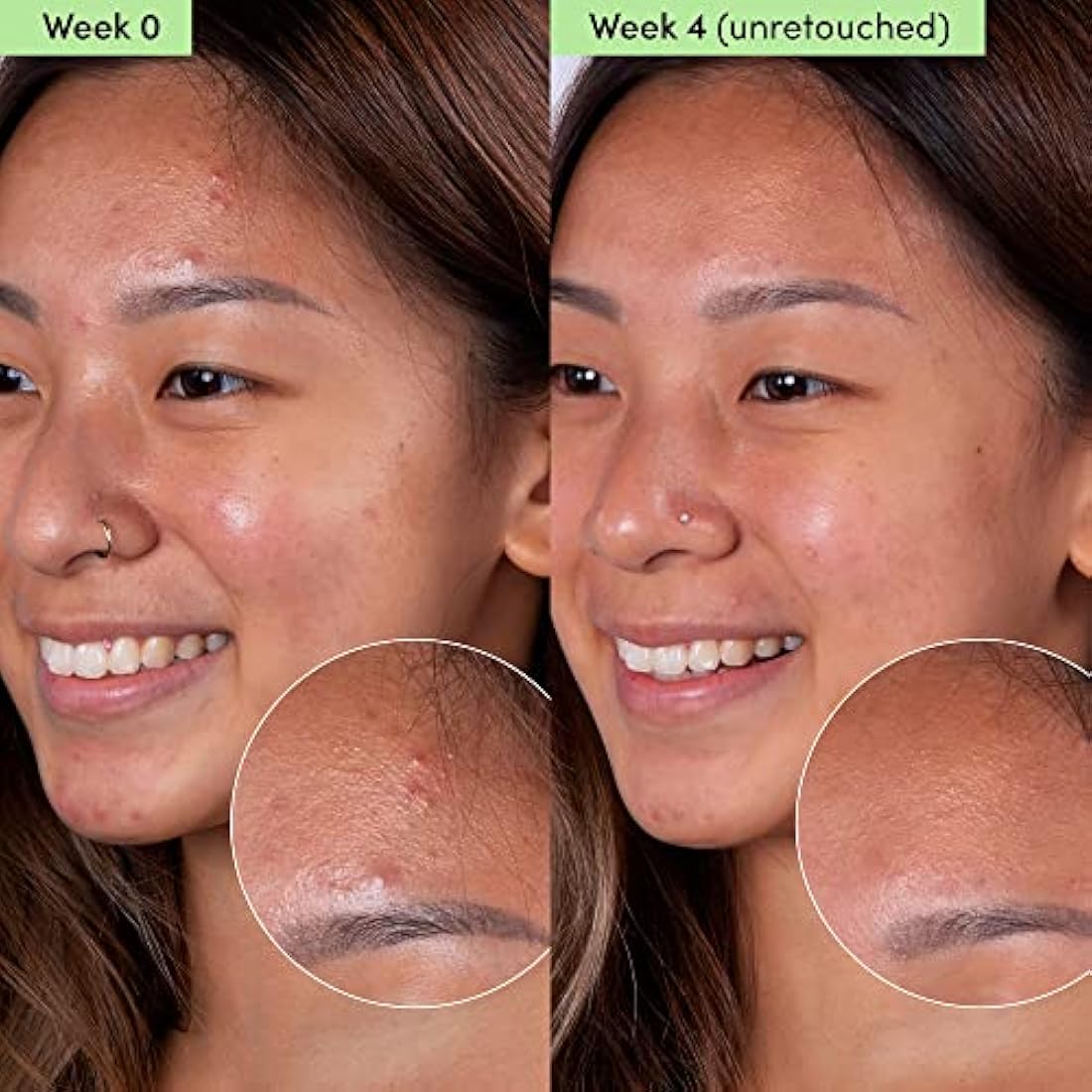 Sand & Sky Oil Control Clay Face Mask with Salicylic Acid & Niacinamide