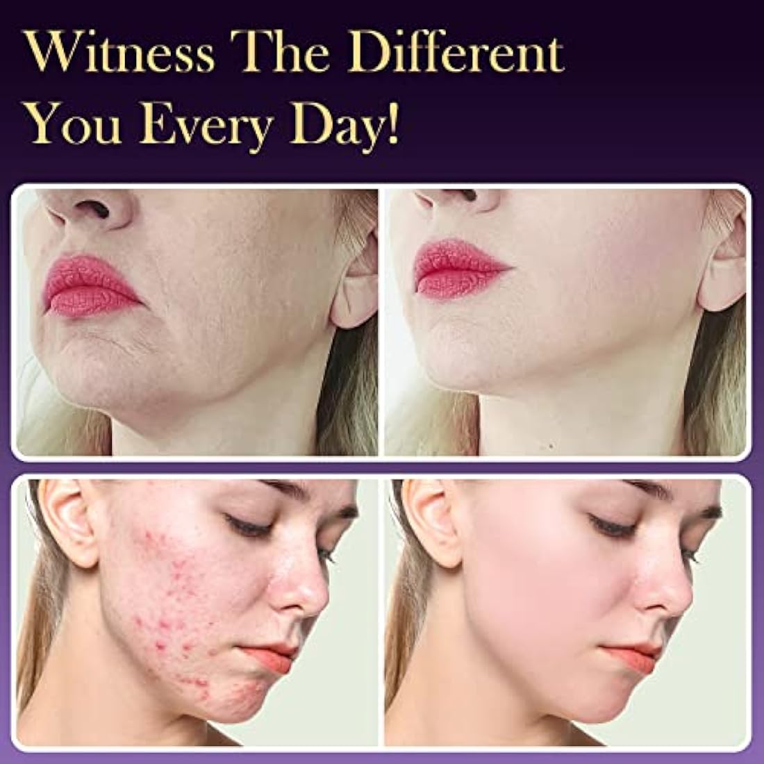 TUMAKOU 6-in-1 High Frequency Wand | Argon Purple Light Facial Machine