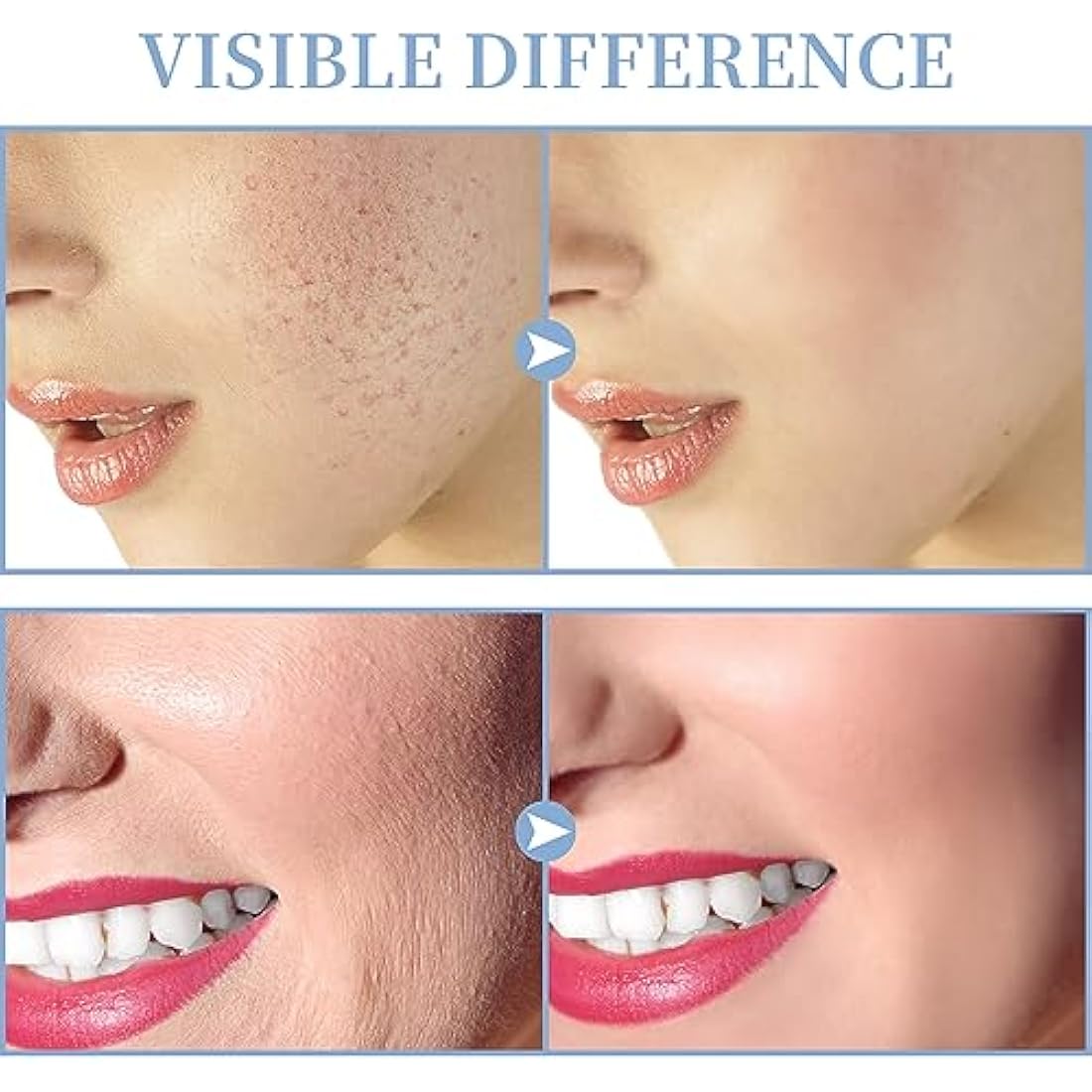TUMAKOU High Frequency Facial Machine | Neon Skin Tightening Wand with 4 Tubes