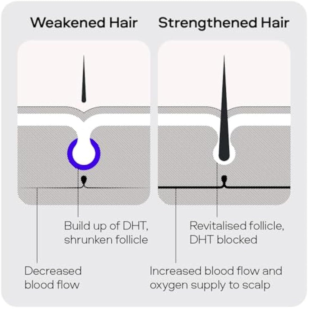 Sons Minoxidil 5% Hair Regrowth Spray for Men | 1 Month Supply (60ml)