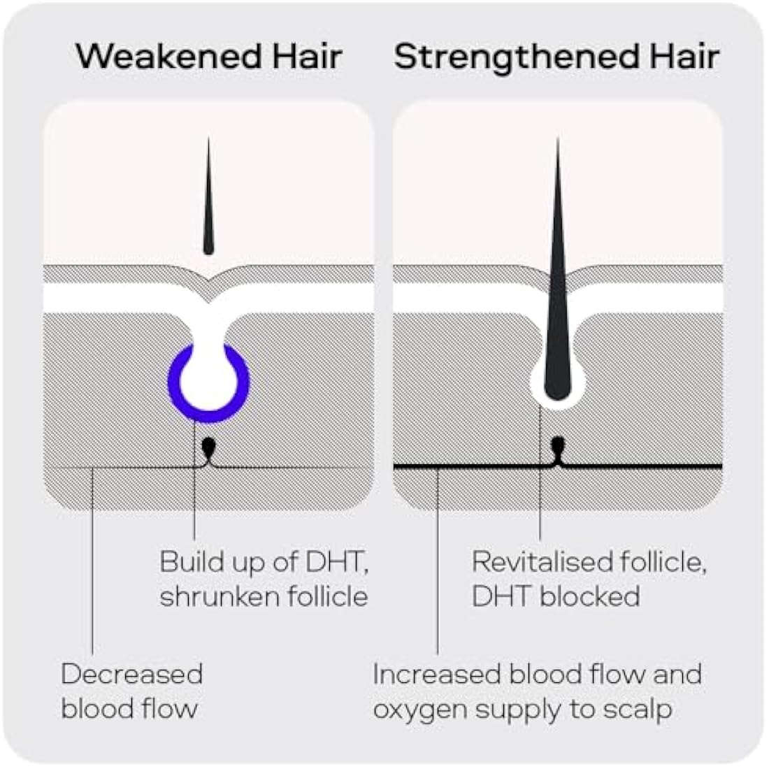 Sons Minoxidil 5% Hair Regrowth Spray for Men | 1 Month Supply (60ml)