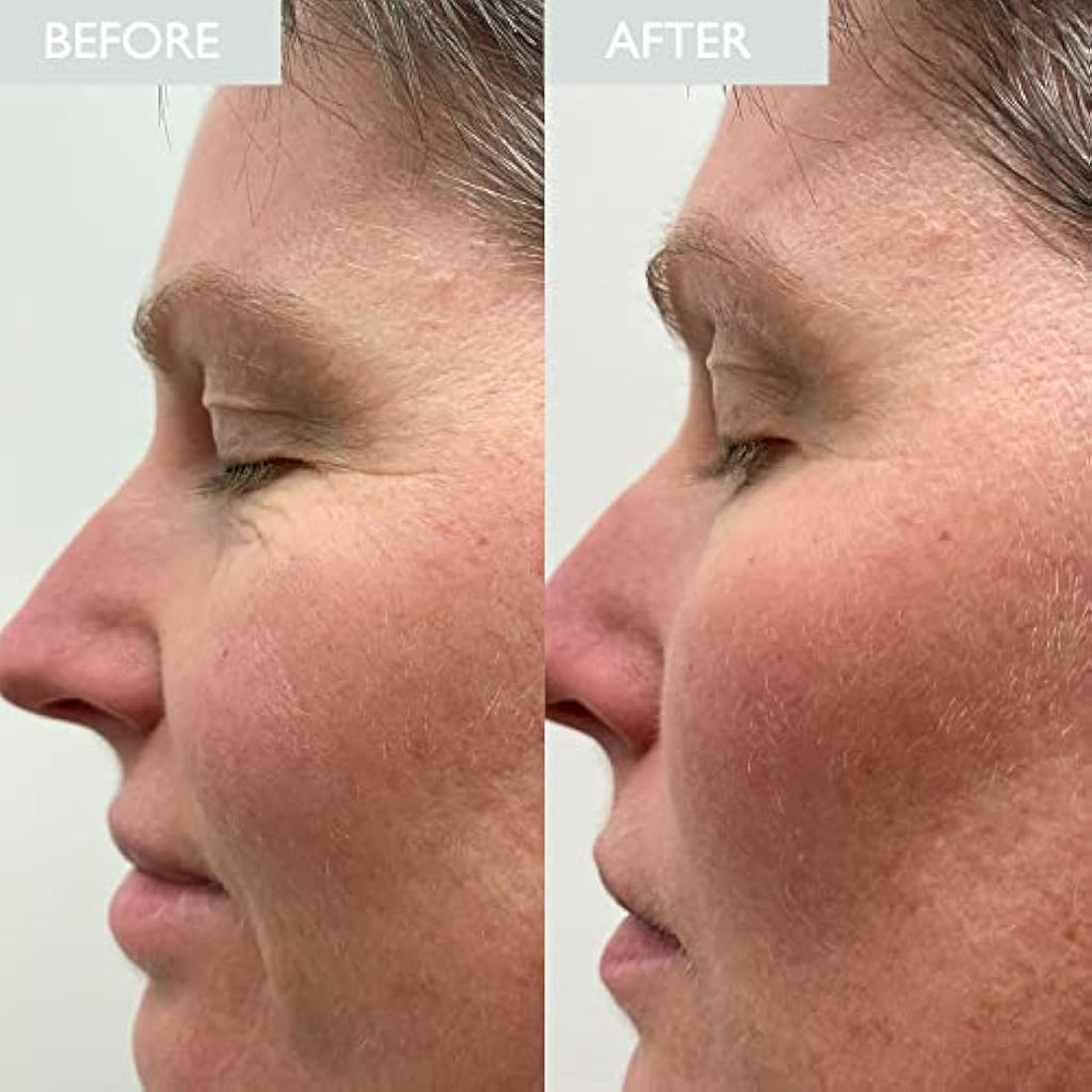 SKINICIAN Multi-Molecular Hyaluronic Elixir | Plumping Hydration Serum