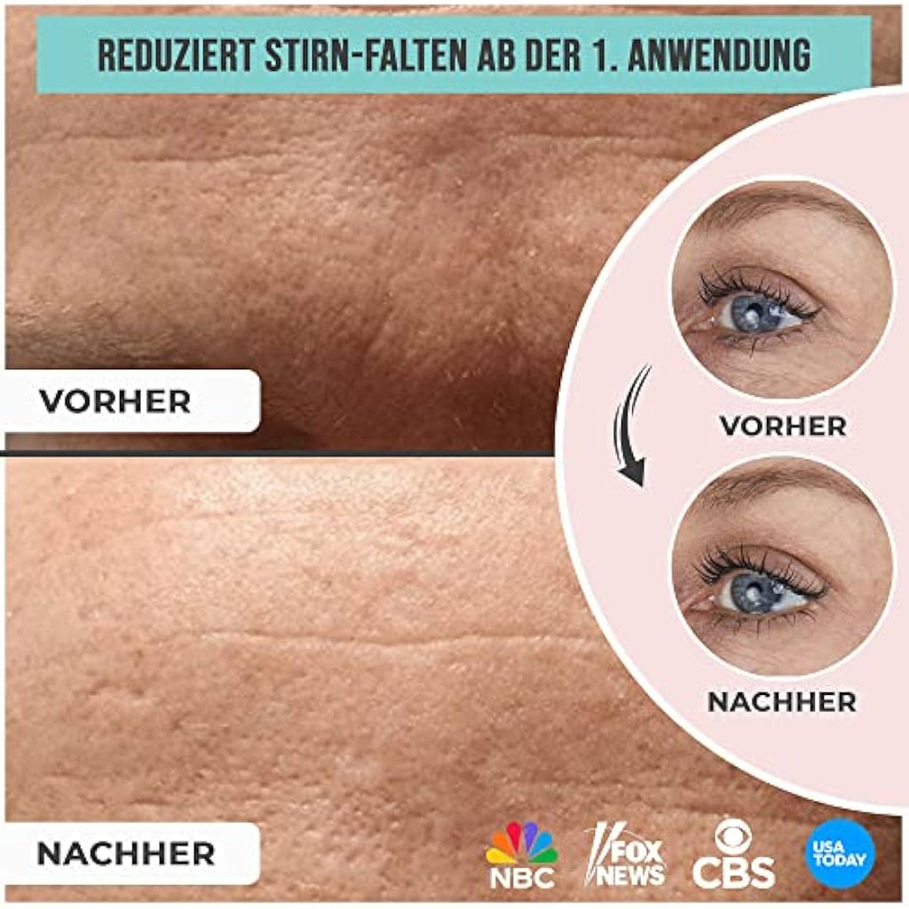 Sandy Skin 2-in-1 Reusable Forehead and Eye Wrinkle Pads