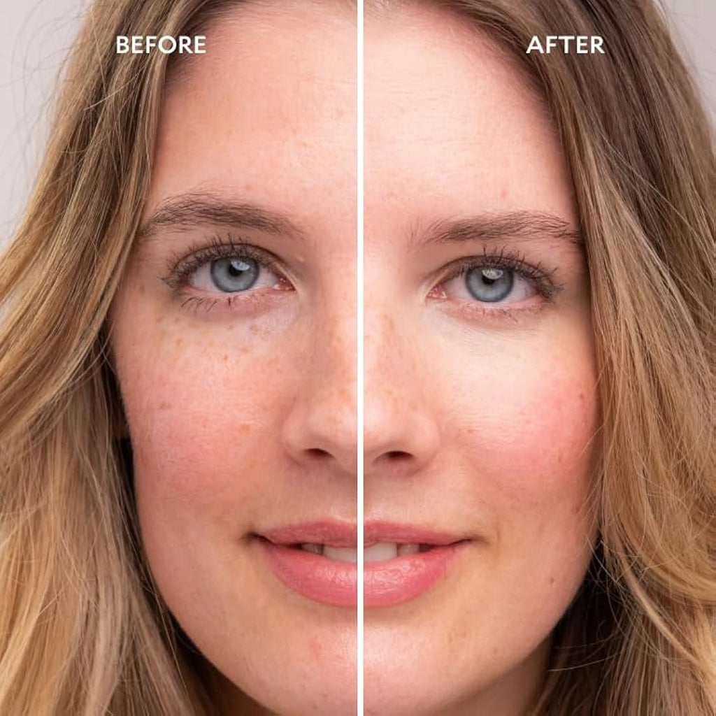 Gatineau Miracle Eye & Face Contour Cream – Hydrating Concealer, 11ml