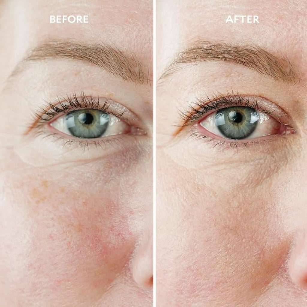 Gatineau Miracle Eye & Face Contour Cream – Hydrating Concealer, 11ml