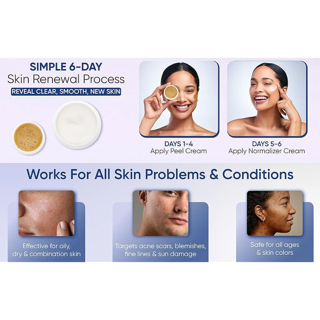 Skin Culture Peel 4000 – Deep Facial Peeling Kit for Acne Scars