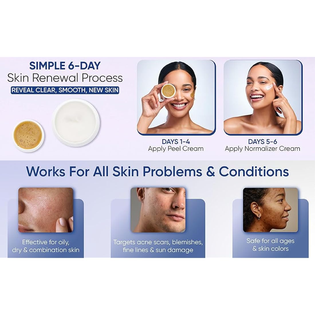 Skin Culture Peel 4000 – Deep Facial Peeling Kit for Acne Scars