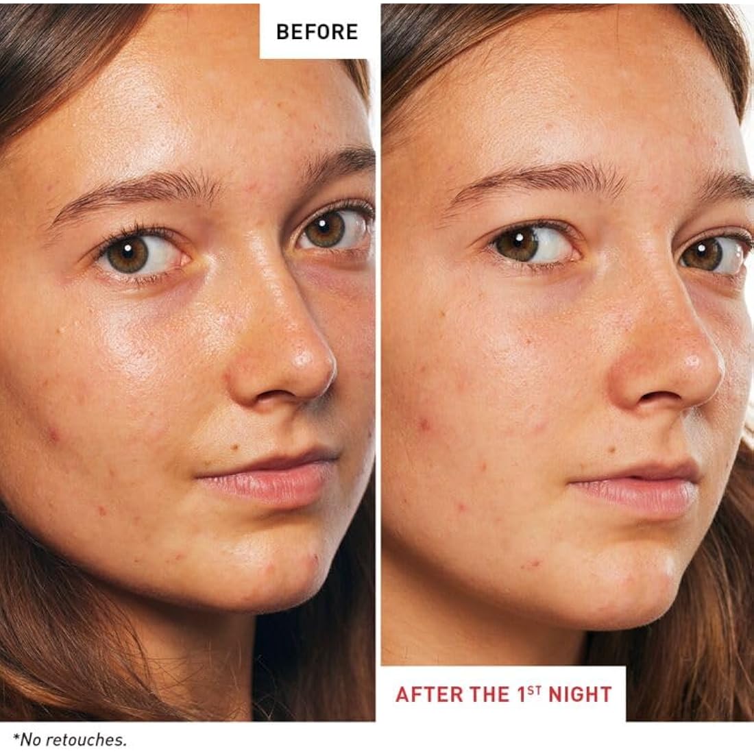Erborian Skin Therapy Night Face Oil-Serum – 17 Super Ingredients – 30ml