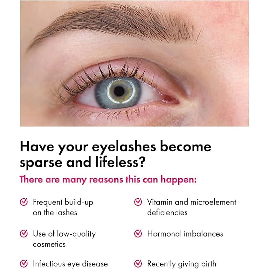TOPLASH Eyelash and Eyebrow Growth Serum – Natural Volumizing Formula