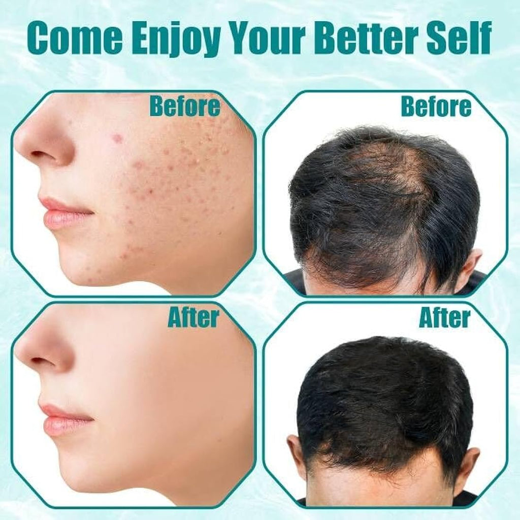 TUMAKOU High Frequency Facial Machine | 6 Argon Tubes for Acne & Aging